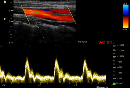 Ressursside i RAT6001 Basal ultralyd MH_ISB